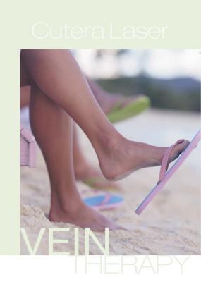 laser vein therapy