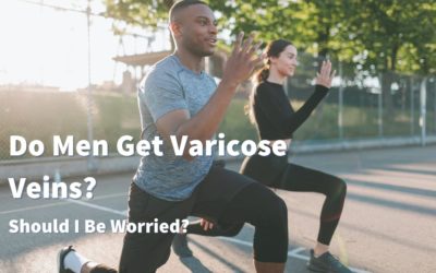 Can Men Get Varicose Veins? Should I Be Worried?